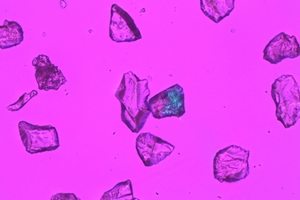  12 Fraction 40-63 µm of crushed GBS 13b (above) and GBS 14 (below) before (left) and after (right) 24 h annealing procedure (transition light microscope) 