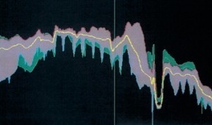  1	Images of the kiln scanner as regards shell temperatures during burning of the extremely coarse and the conventional, fine raw mixes 
	(The kiln inlet end is on the left. The conventional coating ends 2 m in front of the second tyre). 
a)	Two measurements at very coarse raw mix, lilac and green
 