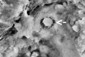  17	UHPC matrix with reacted silica fume particles (see arrows): a) Helix detector image at 0.4 mbar water vapor pressure; b) vCD – BSE-detector image: beam deceleration mode landing energy of the electrons 1.5 keV 