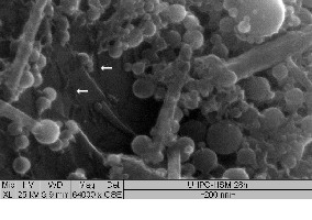  3	ESEM WET-mode (HV: 25 kV), M2-fractured surface at 28 h: UHPC microstructure with first visible C-S-H phases (arrows), SF-particles and ettringite crystals 