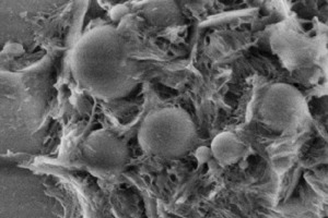  2	Aquisition of UHPC micro structure using the NOVA NANOSEM: a) after 7 days; b) after 28 days 